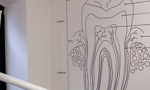 Gemaltes Modell eines Zahns im Behandlungszimmer der Grube Carl in Frechen.