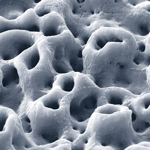 Vergrößerung von Knochensubstanz zur Vorbereitung von Zahnimplantaten in der Zahnarztpraxis Grube Carl in Frechen.